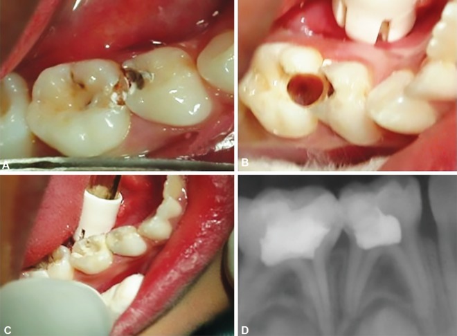 Fig. 3A to D