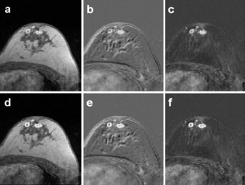 Fig 3