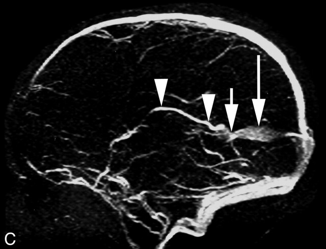 Fig 1.