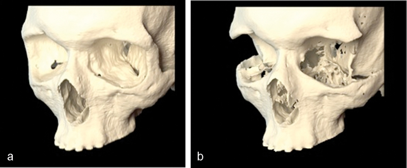 Fig. 11