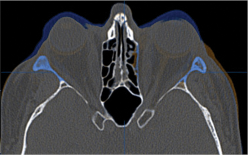 Fig. 10