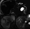 Fig. 21