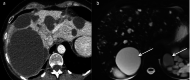 Fig. 15