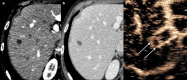 Fig. 22