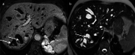 Fig. 12