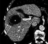 Fig. 26