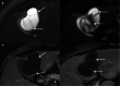 Fig. 19