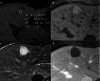 Fig. 18