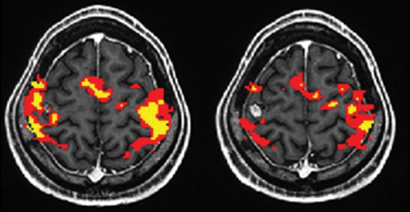 Figure 2: