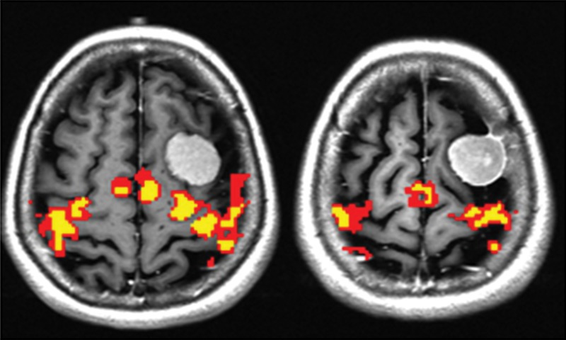 Figure 3: