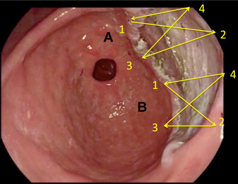 Figure 3