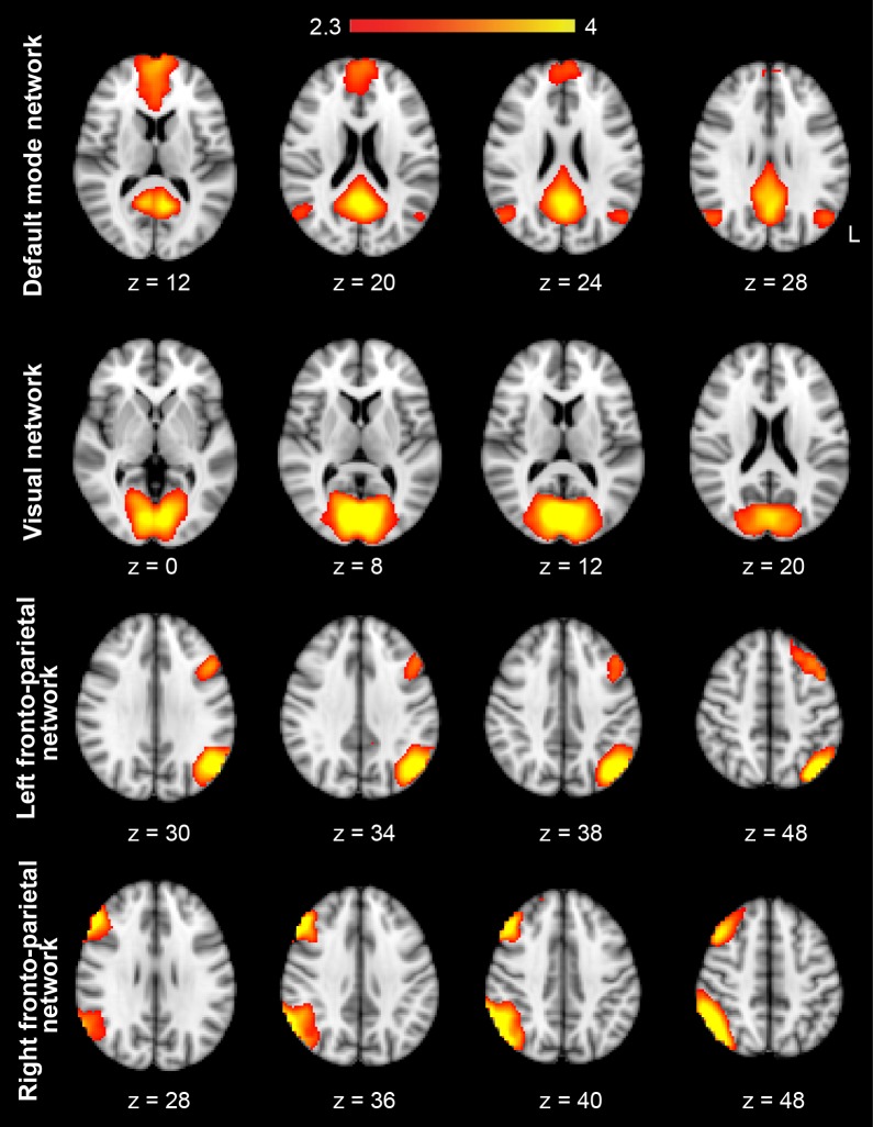 Figure 2—figure supplement 1.