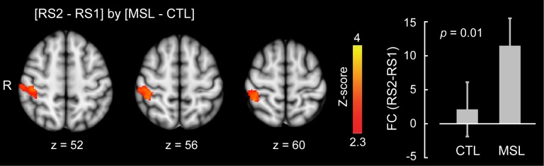 Figure 4—figure supplement 2.