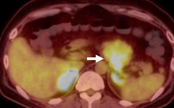Fig. 4