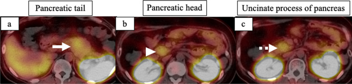 Fig. 3