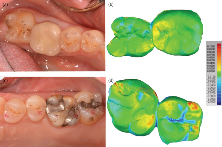 FIGURE 6