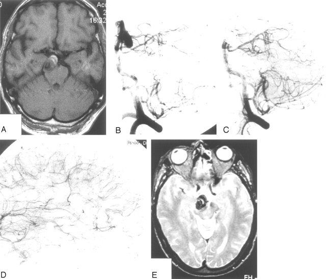 Fig 3.