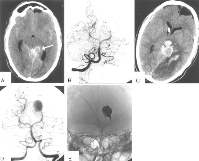 Fig 2.