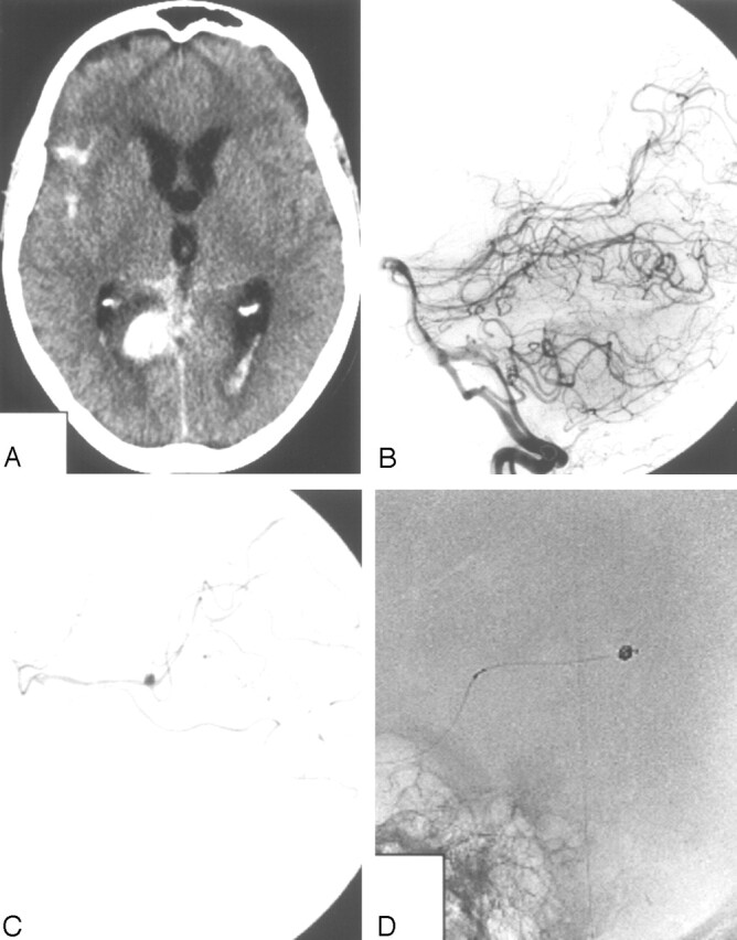 Fig 4.