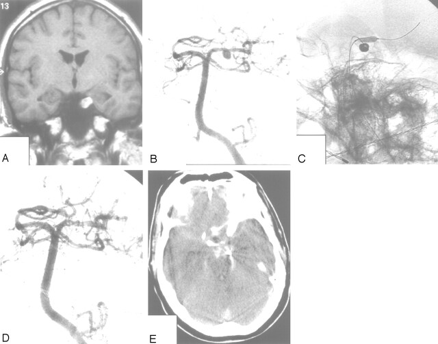 Fig 5.