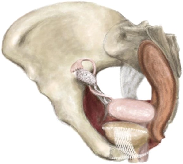 Fig. 1