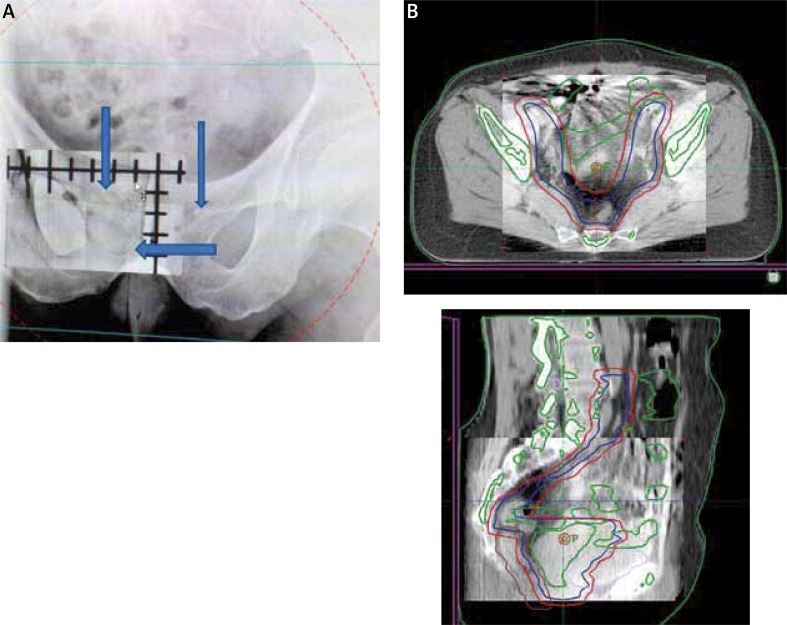 Fig. 4