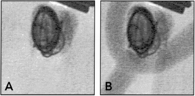 Fig 4.