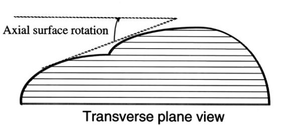 Figure 29