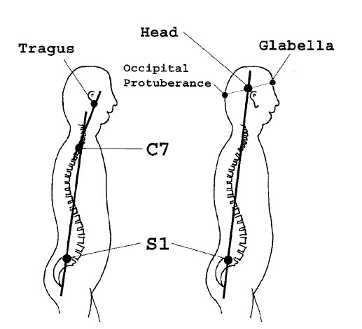 Figure 32