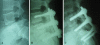Fig. 4A–C