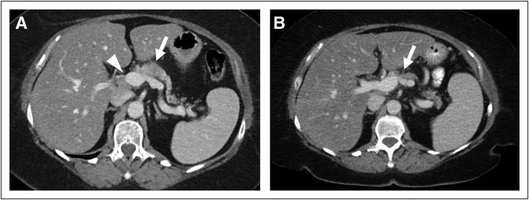 Fig 2.