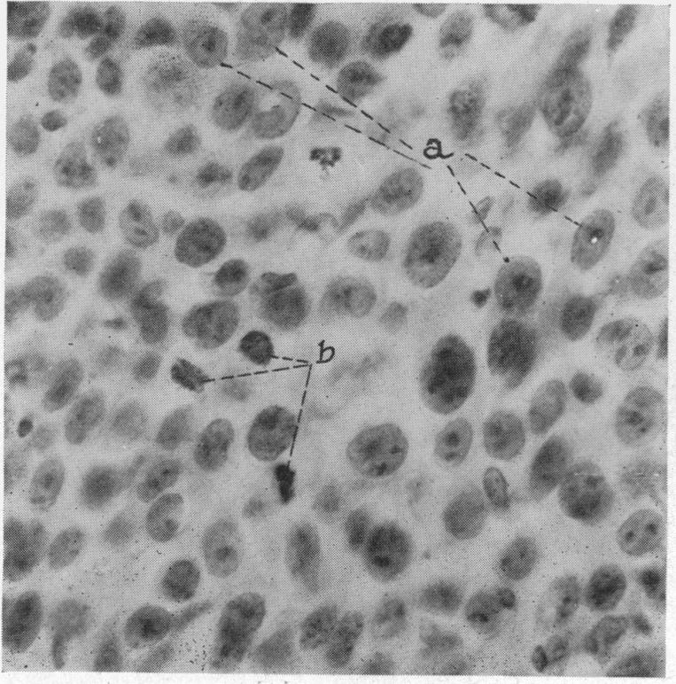 FIG. 13