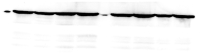 ILK Figure 6C