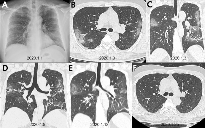 graphic file with name radiol.2020200269.fig1.jpg