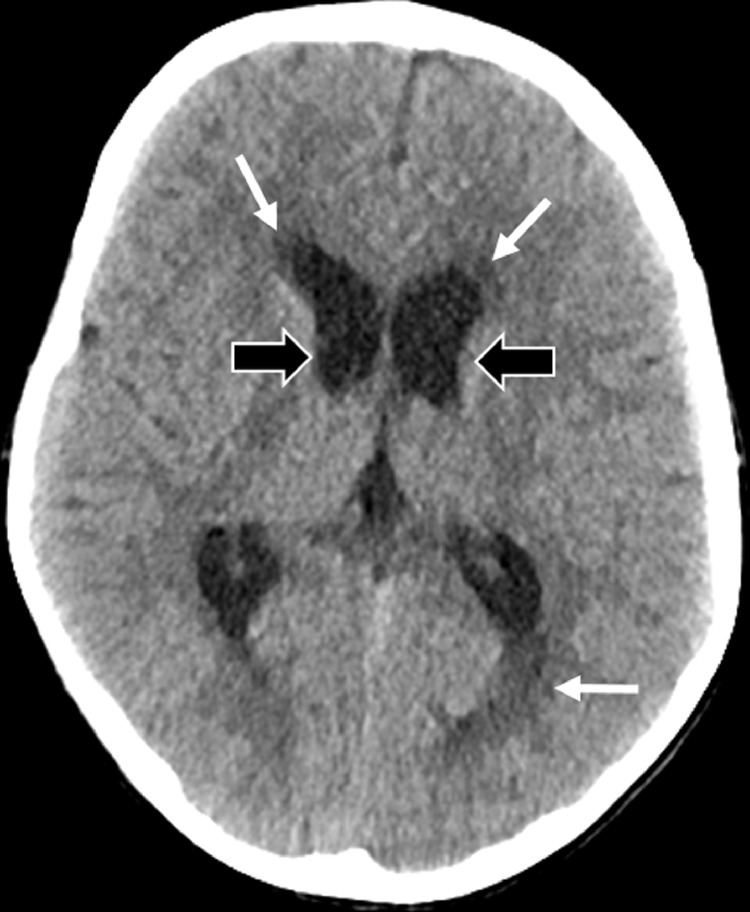 Fig. 5