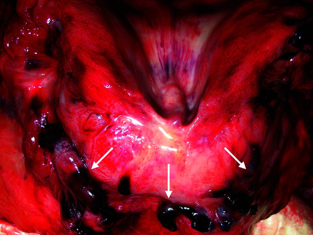 Appendix Figure 1.