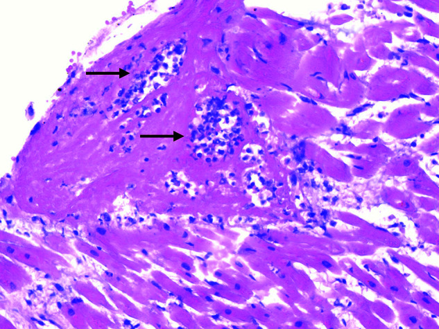 Appendix Figure 2.