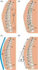 graphic file with name JSP2-3-e1120-g002.jpg