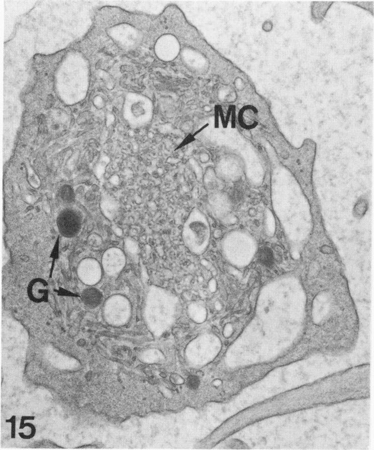 Figure 15