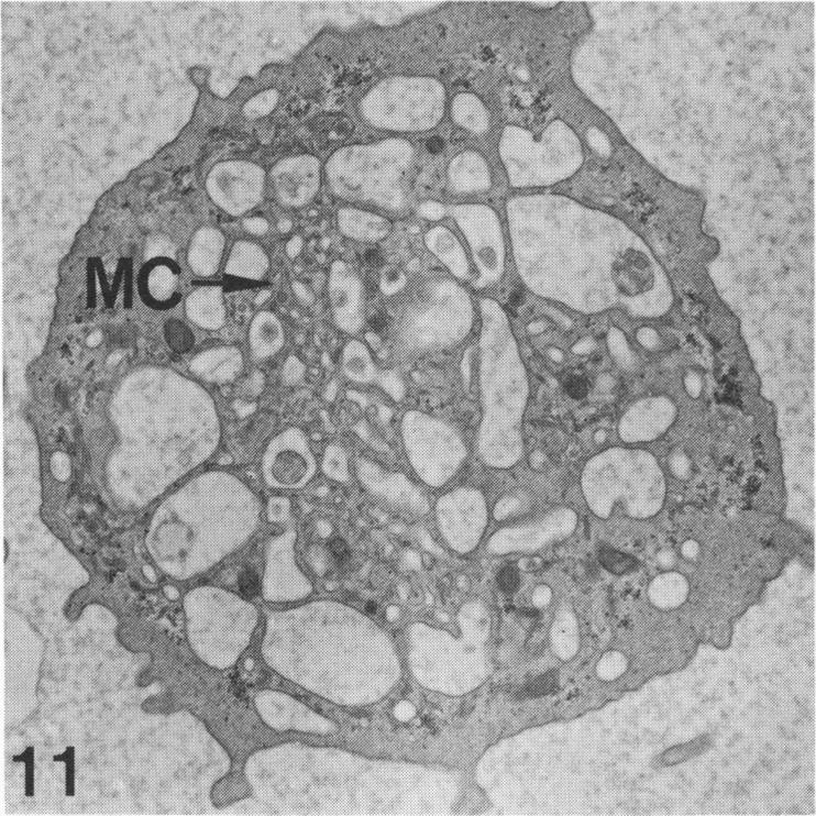 Figure 11