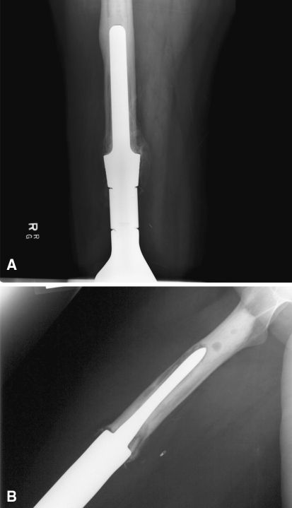 Fig. 2A–B