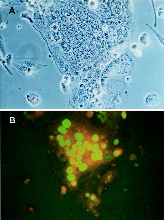FIG. 1