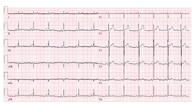 Figure 2.