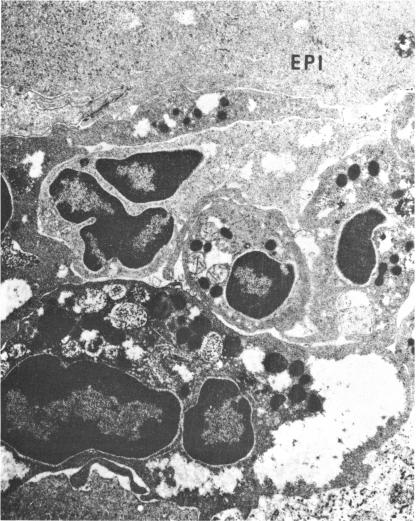 FIGURE 23