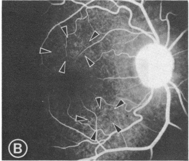 FIGURE 2 B