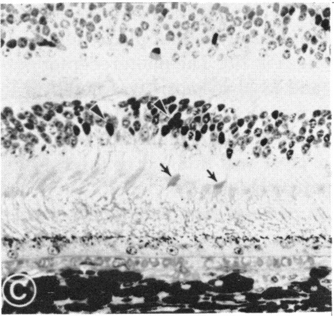 FIGURE 9 C