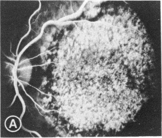 FIGURE 5 A