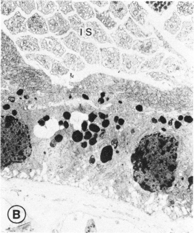 FIGURE 26 B