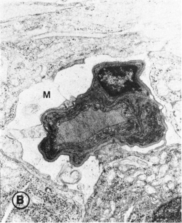 FIGURE 20 B