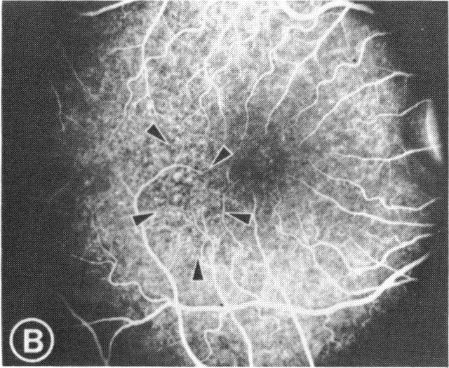 FIGURE 1 B